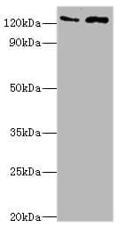 Polyclonal Rabbit anti-Human KDM4B / JMJD2B Antibody (aa1-260, IHC, WB)