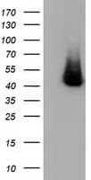 HP / Haptoglobin Antibody (clone OTI6H2)