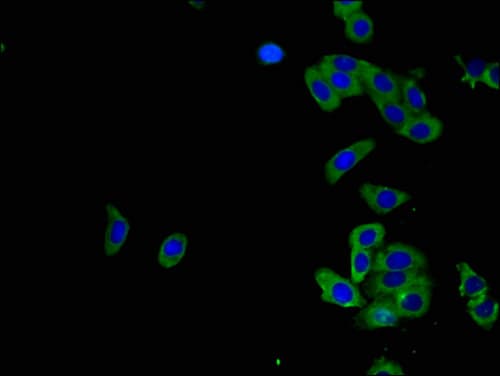 ADORA2B/Adenosine A2B Receptor Antibody