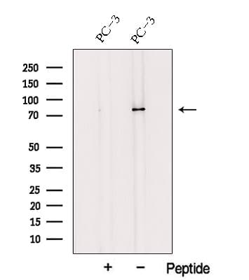 TRPV6 Antibody
