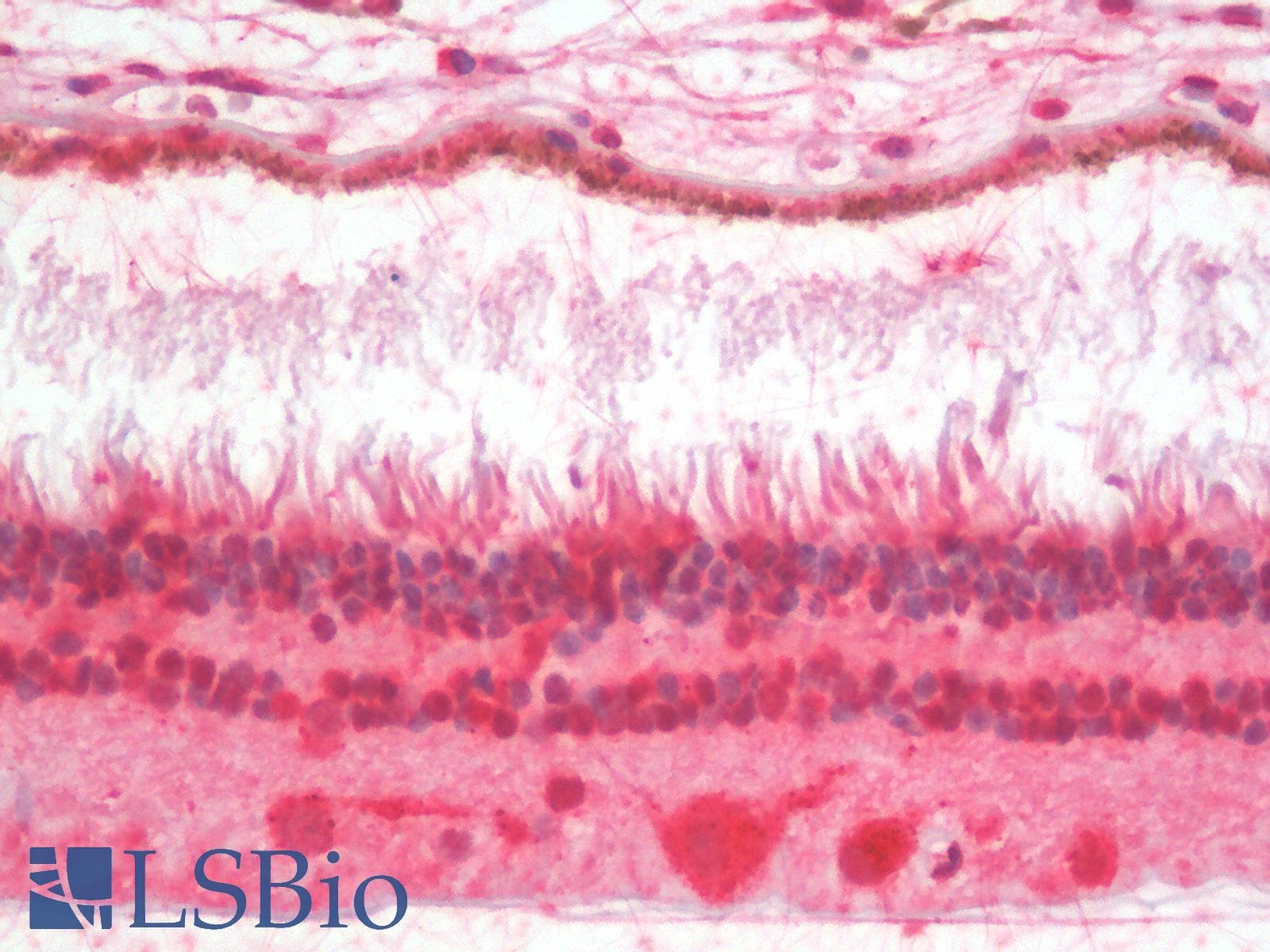 IHC-plus™ CRD / CRX Antibody (aa284-295)