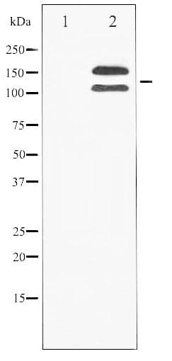 FGFR1 / FGF Receptor 1 Antibody (phospho-Tyr154)