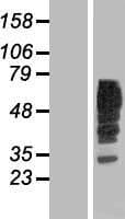 RAB5IF Protein (Over-Expression Lysate Myc-DDK (Flag))