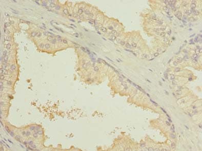SLC7A14 Antibody