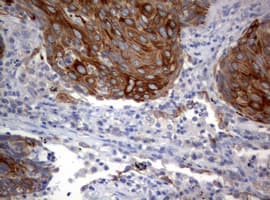 Monoclonal Mouse anti-Human BNIP1 Antibody (clone OTI2B3, aa1-199, IHC, WB)