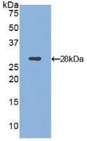 ITGAD / CD11d Antibody (aa886-1106)
