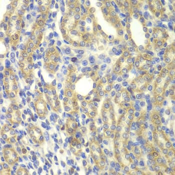 KBTBD7 Antibody