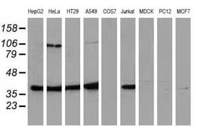 MAPK12 / ERK6 / SAPK3 Antibody (clone OTI4C1)