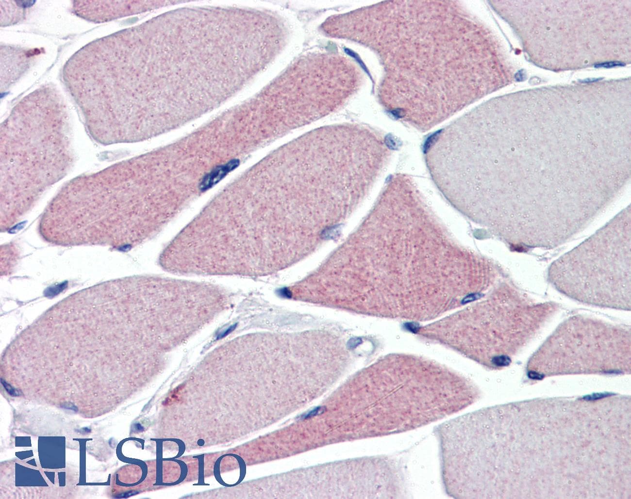 IHC-plus™ TRPA1 Antibody (N-Terminus)