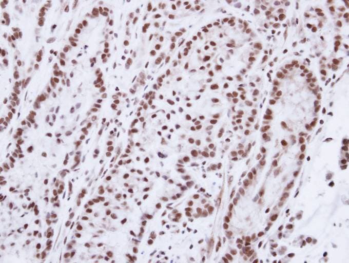 PR / Progesterone Receptor Antibody (aa18-112)