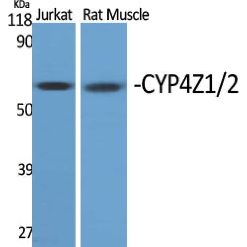 Polyclonal Rabbit anti-Human CYP4Z1 Antibody (Internal, IHC, WB)