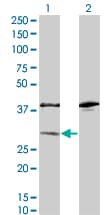 SULT1A1 / Sulfotransferase 1A1 Antibody (clone 1F8)