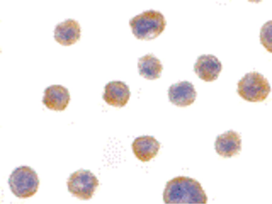 IHC-plus™ Polyclonal Rabbit anti-Human SH3GLB1 / Bif / Endophilin B1 Antibody (IHC, WB)
