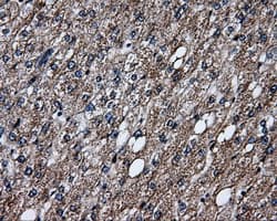 HSD17B10 / HADH2 Antibody (clone OTI10B4)