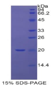 Human RBP5 Protein (Recombinant His-T7)
