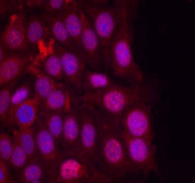Polyclonal Rabbit anti-Human PR / Progesterone Receptor Antibody (IHC, IF, WB)