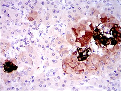 SST / Somatostatin Antibody (clone 7G5)