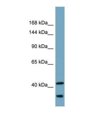 UBR2 Antibody (aa314-363)