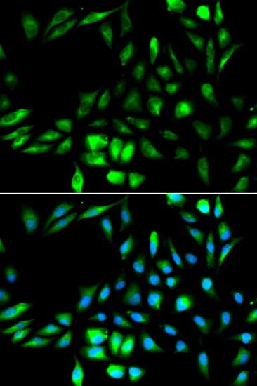 IHC-plus™ KPNA2 / Importin Alpha 1 Antibody