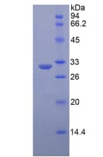 Human LRP6 Protein (Recombinant His, N-Terminal)