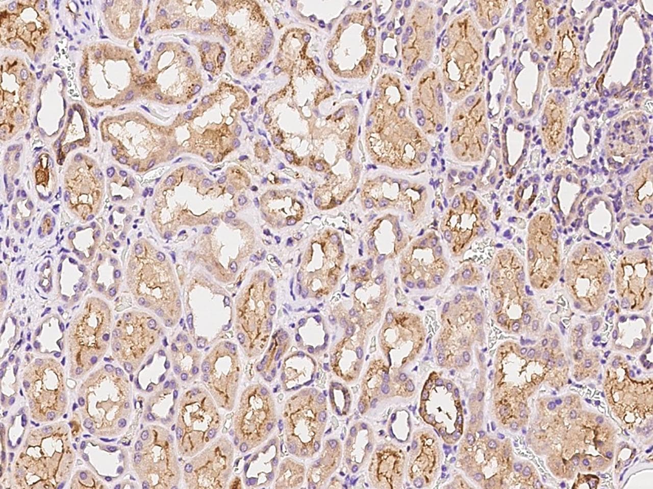 MIA / CD-RAP Antibody