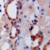 GOPC / PIST Antibody