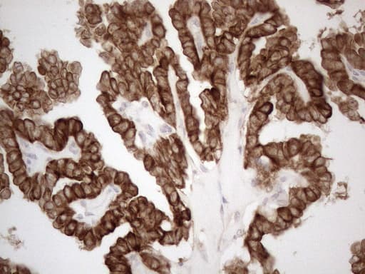 KRT18 / CK18 / Cytokeratin 18 Antibody (aa69-372, clone OTI2H10)