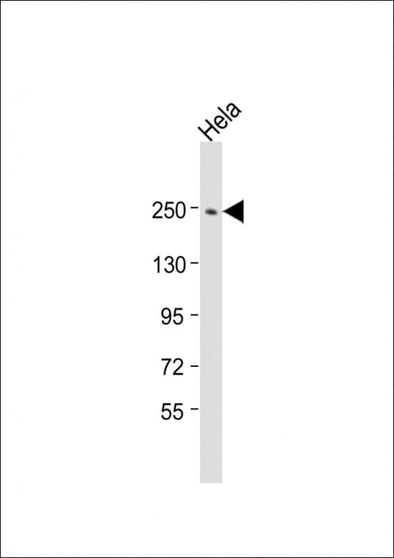 Polyclonal Rabbit anti-Human APCL / APC2 Antibody (aa122-152, WB)