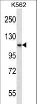 PACE4 / PCSK6 Antibody (aa659-688)