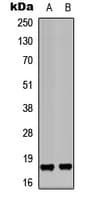 PPP1R14C / KEPI Antibody (Internal)