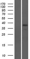 ODF3B Protein (Over-Expression Lysate Myc-DDK (Flag))
