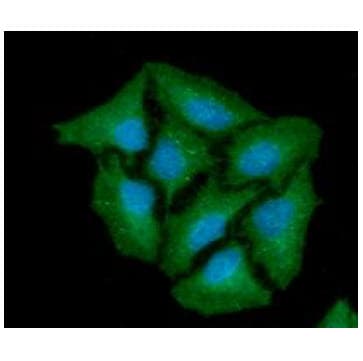 IHC-plus™ Monoclonal Mouse anti-Human CTSZ / Cathepsin Z Antibody (clone AT6G11, IHC, IF, WB)