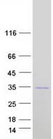 Human SYCP3 / SCP3 Protein (Recombinant Myc-DDK (Flag))