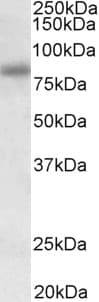 IHC-plus™ SDCCAG8 Antibody (aa121-135)