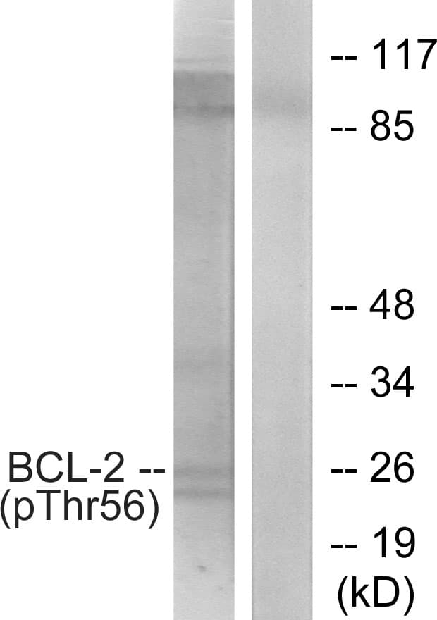 BCL2 / Bcl-2 Antibody (phospho-Thr56)