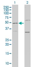 Monoclonal Mouse anti-Human P3H1 / LEPRE1 Antibody (clone 3C7, IHC, IF, WB)