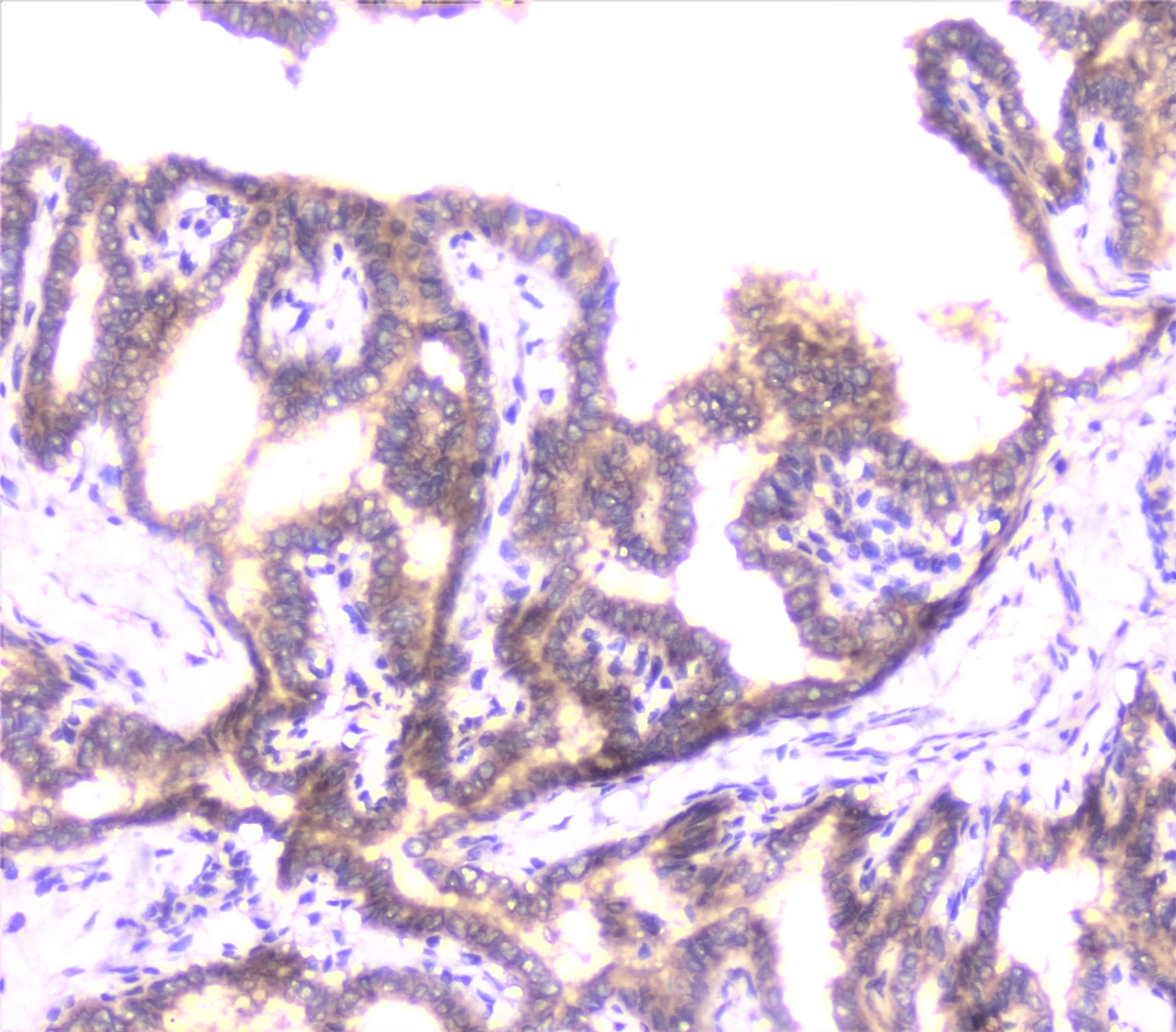 UBE2I / UBC9 Antibody