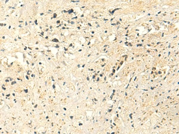 HsT19268 / MTHFS Antibody