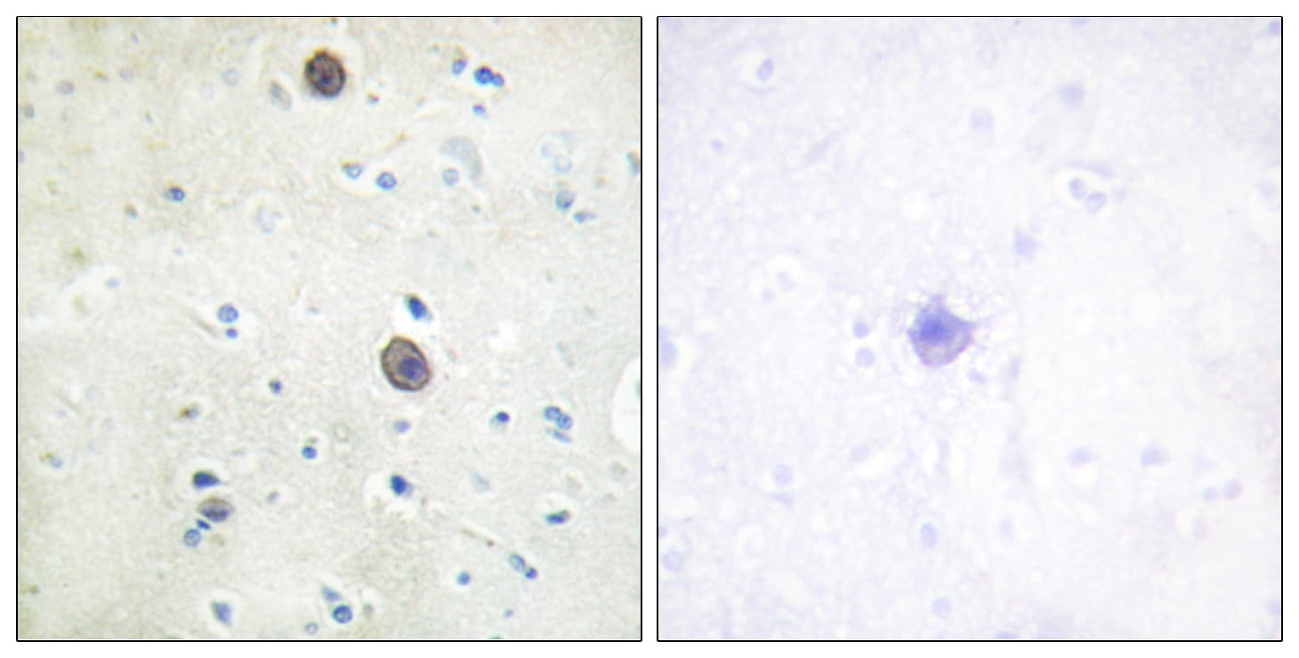 APP / Beta Amyloid Precursor Antibody (phospho-Thr743/Thr668)