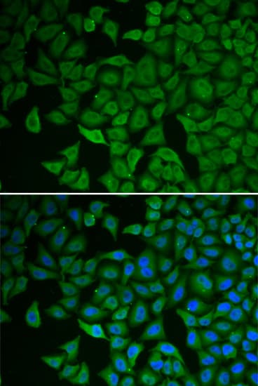 CHEK2 / CHK2 Antibody
