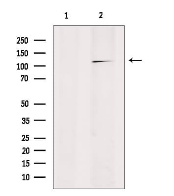 RANBP17 Antibody