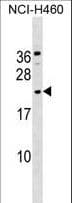 Polyclonal Rabbit anti-Human GLIPR1L1 Antibody (aa196-224, WB)