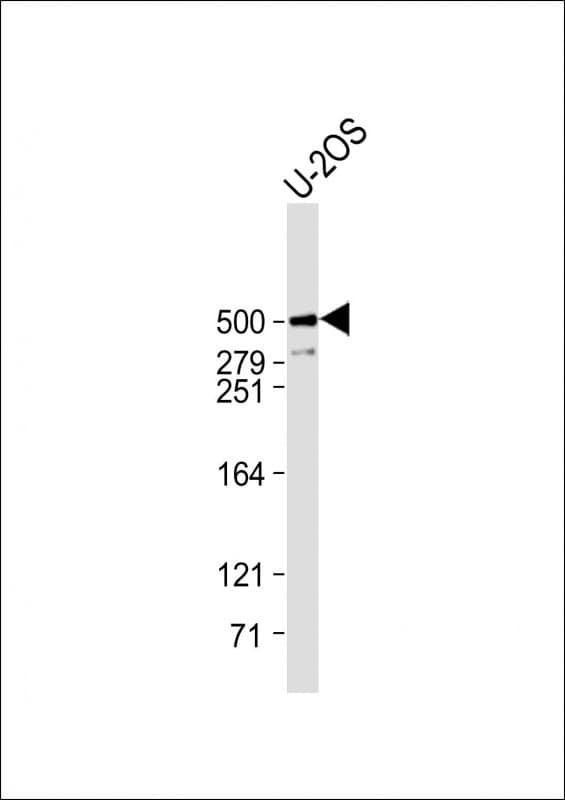 PLEC / Plectin Antibody (C-Terminus)