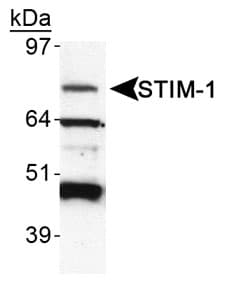 GOK / STIM1 Antibody (aa600-685)
