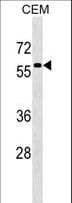 MSL3L1 / MSL3 Antibody (aa28-55)