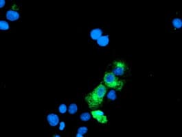 GOLM1 / GP73 / GOLPH2 Antibody (clone OTI5F4)