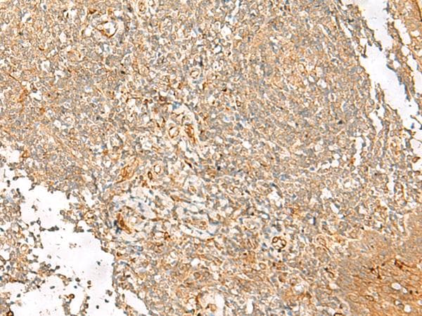 FGL2 Antibody