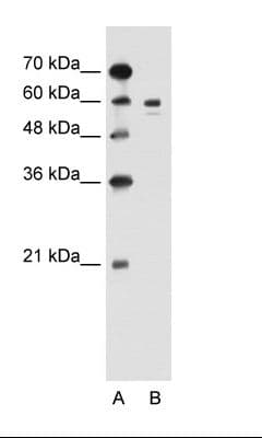 Tyrosinase Antibody (aa321-370)
