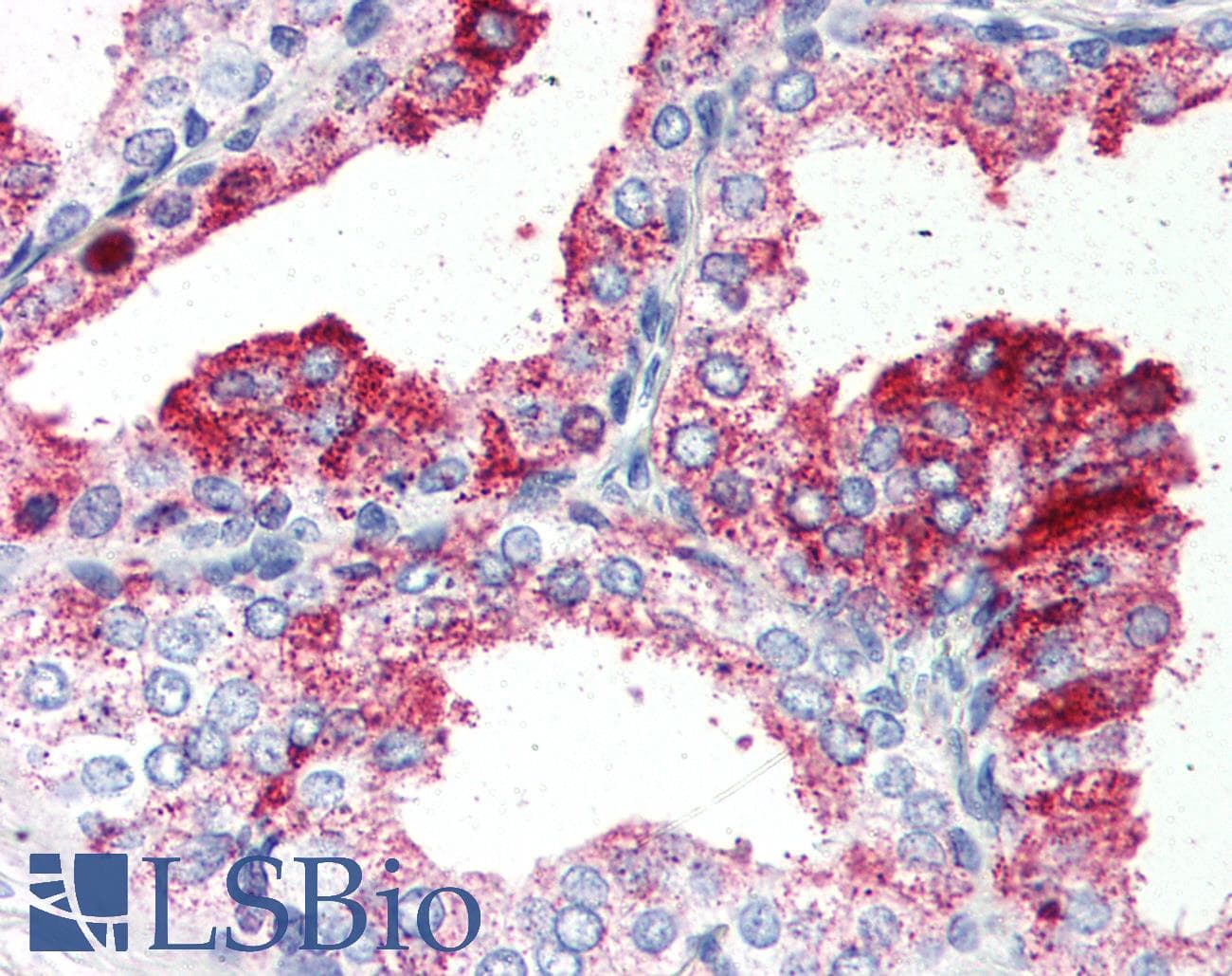 IHC-plus™ Polyclonal Rabbit anti-Human GPR27 Antibody (Cytoplasmic Domain, IHC)