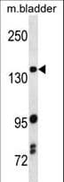 MAP3K5 / ASK1 Antibody (aa1175-1203)